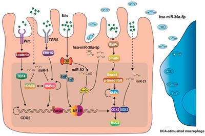 The role of bile acid in intestinal metaplasia